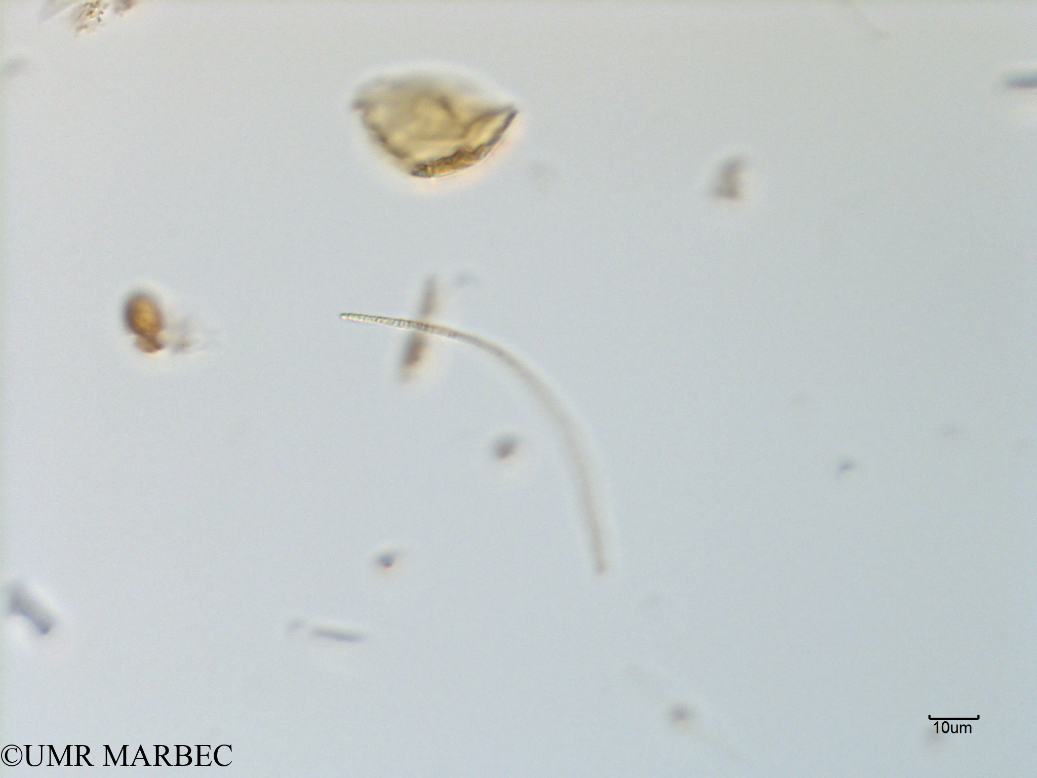 phyto/Scattered_Islands/mayotte_lagoon/SIREME May 2016/Oscillatoriale spp (MAY11_cyano-4).tif(copy).jpg